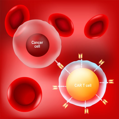 CAR-T Zelltherapie