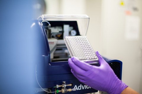Mit dem Massenspektrometer identifizierten die Wissenschaftler über 200 verschiedene Lipide aus dem Blutplasma anhand deren Masse und Ladung.