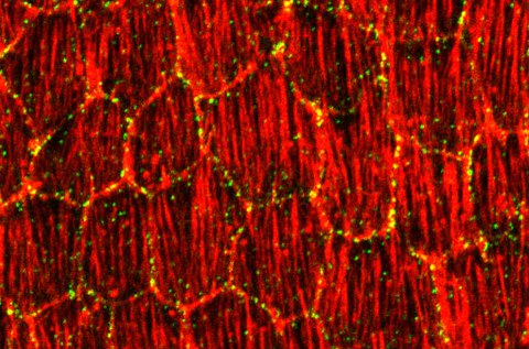 Planar polarity in the follicle epithelium