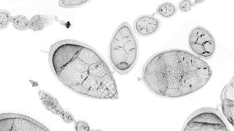 F-actin staining of Drosophila ovarioles with egg chambers in different stages. Knock-down of either one basement membrane (BM) main component results in a change of BM mechanical properties and changes in the shapes of egg chambers.