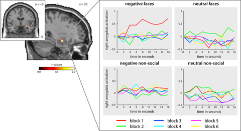 Amygdala activation for emotional stimuli