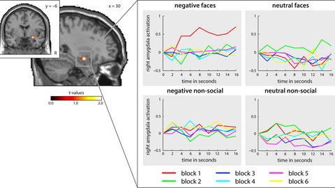 Amygdala activation for emotional stimuli