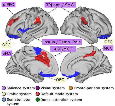 Brain activity regarding social support