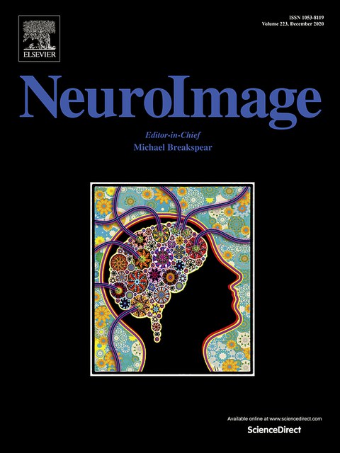 NeuroImage