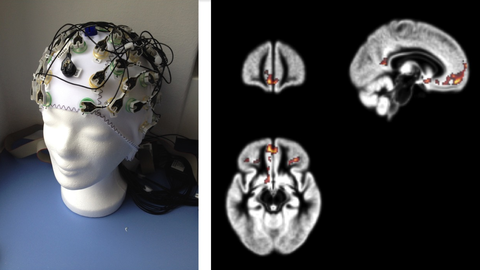 the pictures made with the method of functional magnetic resonance tomography