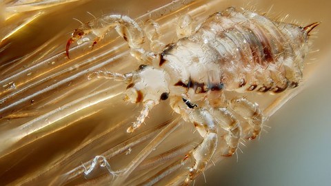 Kopflaus