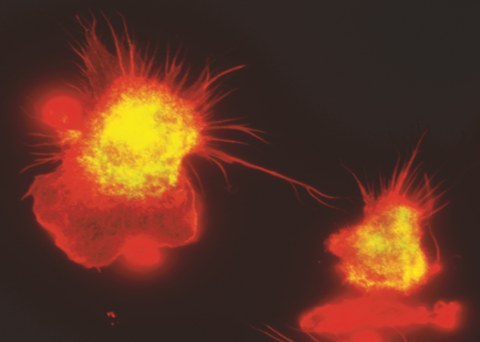 Two macrophages under a microscope.