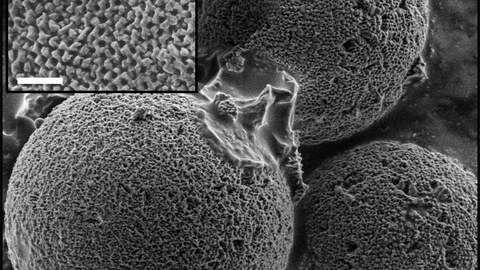Mikroskopische Aufnahme der mineralisierten Calcit-Schalen einzelliger Algen