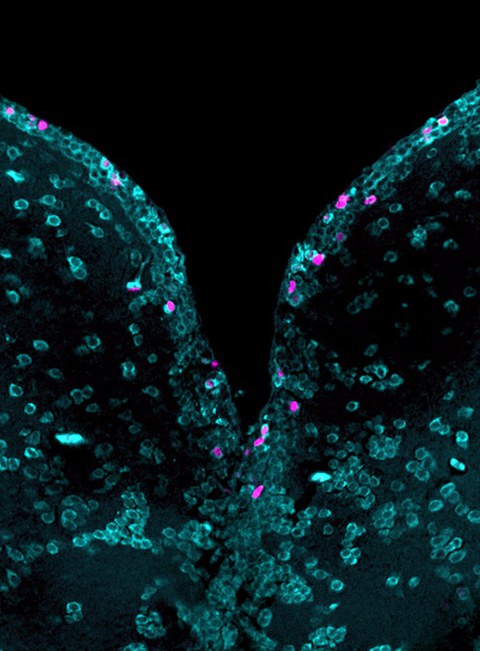 Fluoreszenz-Mikroskopaufnahme von Gehirnzellen des Zebrafisches: Neugebildete Neuronen haben Magenta gefärbte Kerne und sind von türkisen Zellkörpern umgeben