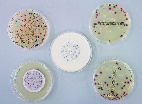 Aus der Wasserprobe einer Kläranlage isolierte Bakterien auf ESBL-Agar: E.coli, Klebisella und Acenetobacter/Pseudomonas.
