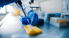 Foto: Hand mit blauen Handschuhen pipettiert Flüssigkeit in eine gelbe Laborplatte auf einem Labortisch.