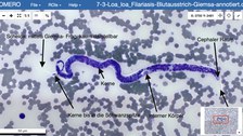 Virtuelle Mikroskopie mit Beschriftung