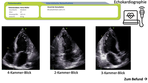 im E-Learning angezeigte Echokardiographiebilder der Herzkammern