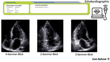 im E-Learning angezeigte Echokardiographiebilder der Herzkammern