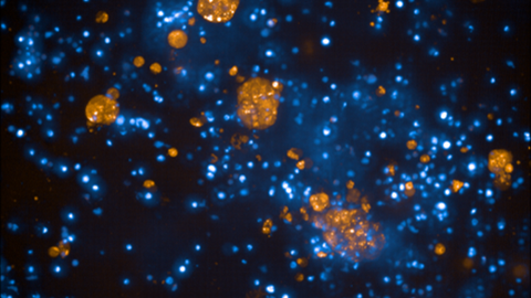 Mikroskopische Aufnahme mit zahlreichen leuchtend blauen und orangefarbenen Punkten und Zellstrukturen auf dunklem Hintergrund. Die unterschiedlich großen, orange markierten Cluster heben sich deutlich von den fein verteilten blauen Strukturen ab.