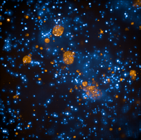 Microscopic image showing numerous glowing blue and orange dots and cellular structures against a dark background. The differently sized orange clusters stand out clearly from the finely distributed blue structures.